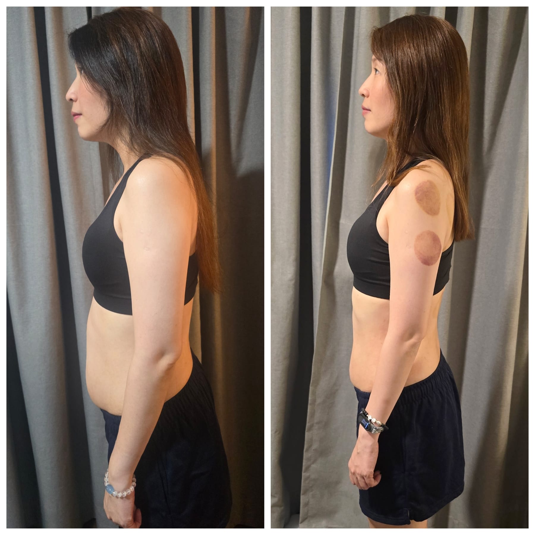 Before and After - Cheryl